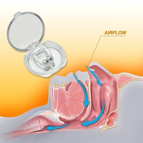 30Pcs Anti-Snore Kit - Nose Vents, Clips & Nasal Strips — view 4