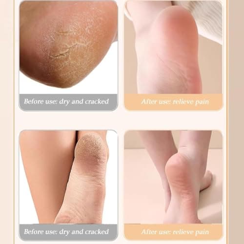 2PCS Silicone Socks for Moisturising Feet, Silicone Foot Care Socks, Silicone Gel Socks for Women Dry Feet Daily Use,Soft Gel Foot Socks for Dry Cracked Feet&Heel — view 3