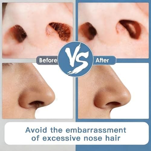 5PCS 2-in-1 Nose Hair Trimmer for Men and Women, Double Sided Nasal Hair Trimmer, 360° Painless Nose Trimmer Men & Ladies, Ear and Nose Hair Trimmer for Men (White) — view 4