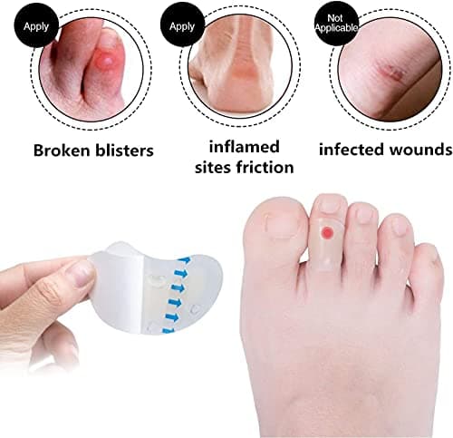 15 Pieces Blister Plasters Invisible Hydrocolloid Gel Blister Bandages Blister Cushion Pad for Heel Foot Toe and Guard Skin — view 4