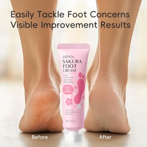 Daily Foot Lotion for Dry Rough Skin — view 6
