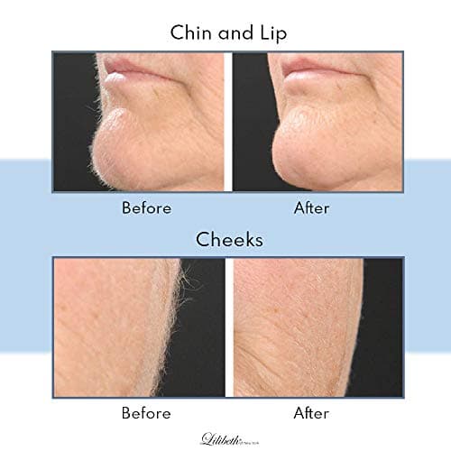 Lilibeth of New York Original Brow Shaper - Foldable Eyebrow Trimmer & Facial Hair Removal Device - Peach Fuzz Remover - Dermaplaning Tool for Women - Pack of 2 (Lavender) — view 4