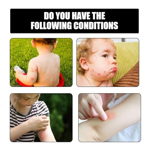 Ultrasonic Mosquito Repellent Bracelet, Electronic Insect Repellent Watch, Rechargeable Anti Mosquito Bracelet & Insect Repellent Band, Long Lasting Protection Ultrasonic Mosquito Repellent (Black) — view 4