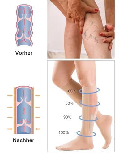 Medical Compression Socks for Women & Men, 20-30mmHg Class 2, Best Graduated Flight Socks /Support Stockings for Travel, Flying, Nursing, Circulation & Varicose Veins (Beige, L) — view 3