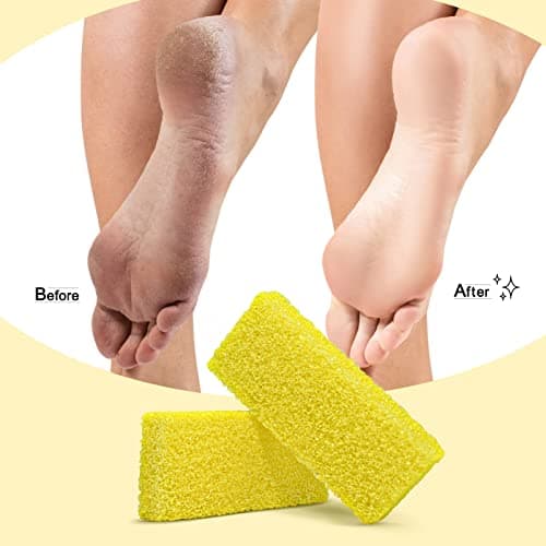 SALVMARY Disposable Pumice Stone for Feet Hard Skin Callus Remover Foot Scrubber Yellow 40 Pcs — view 2