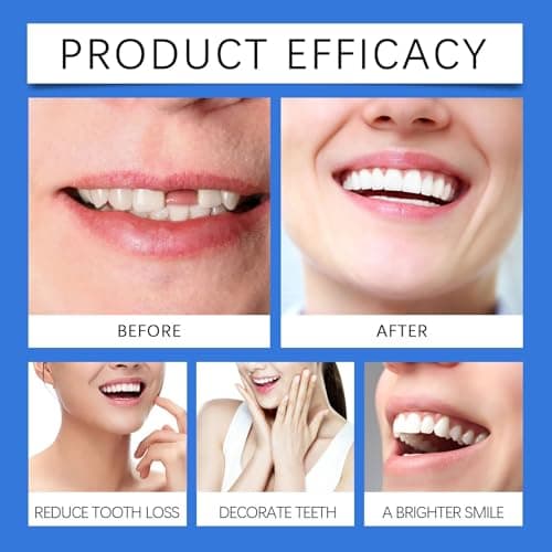 Soft Adjustable Silicone Dentures Teeth Top and Bottom, False Teeth Set Full Dentures, Comfortable Reline Denture Kit, Natural-Looking Functional Temporary Tooth Filling Repair, Functional Dentures — view 4