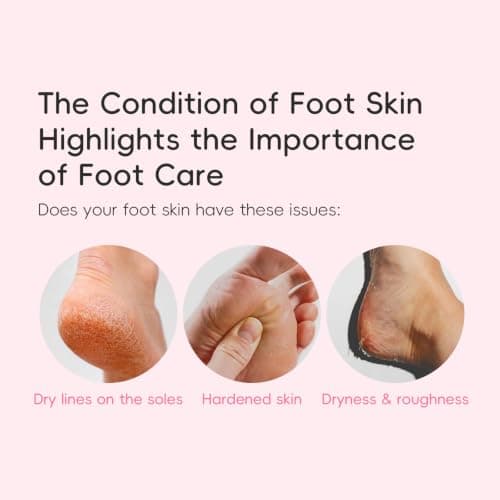 Daily Foot Lotion for Dry Rough Skin — view 4