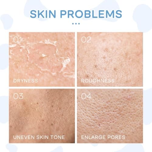 LAIKOU Milk Skincare Set, 5Pcs Nourishing Face Care Routine Kit — view 3