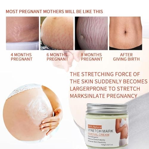 Stretch Mark Belly Cream - Fast Absorbing Pregnancy Skin Care, Smoothing Body Lotion | 100g, Hydrating Formula, Home Travel Business Trip, Daily Nourishing, Soft Elastic Feel — view 3
