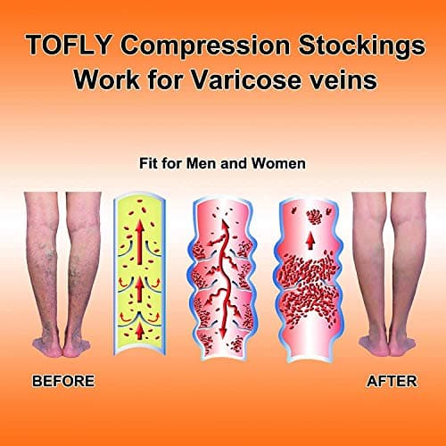 TOFLY® Calf Compression Sleeve for Men & Women, 1 Pair, Footless Compression Socks 20-30mmHg for Leg Support, Shin Splint, Pain Relief, Swelling, Varicose Veins, Maternity, Nursing, Travel, Black XL — view 6