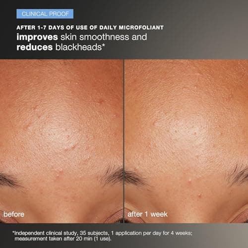 Dermalogica Discover Healthy Skin Kit Gift Edition — view 4