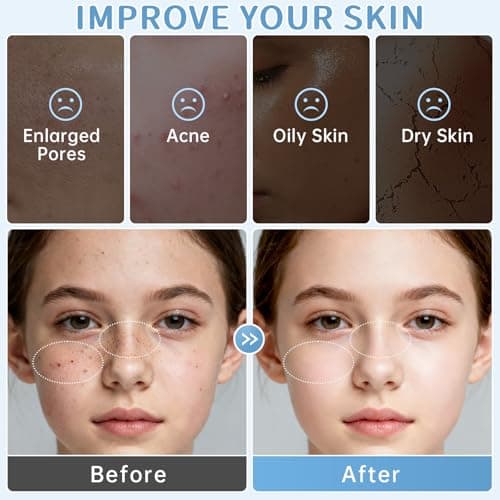 Milk Skin Care Routine Set For Girls, Teen Skin Care Gift Set With Cleanser, Serum, Cream, Eye Cream, Face Skincare Travel Kit For Kids Ages 8-12, Shrink Pores, Hydrating — view 5