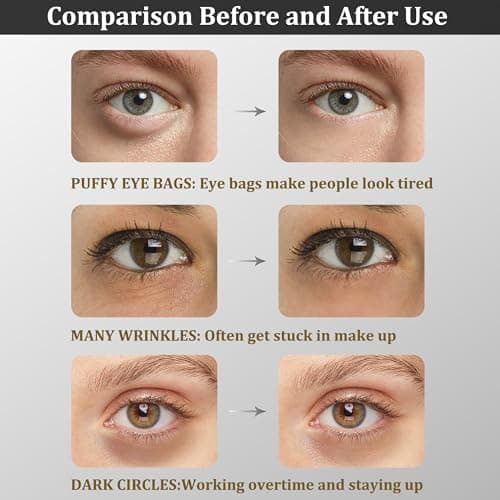 Under Eye Patches, Collagen Under Eye Mask, Dark Circles Under Eye Treatment, Puffy Eyes Bags Under Eyes Removal, Anti-Aging, Reduce Wrinkle, Skincare, Hydrating - 30 Pairs (Bamboo Charcoal) — view 3