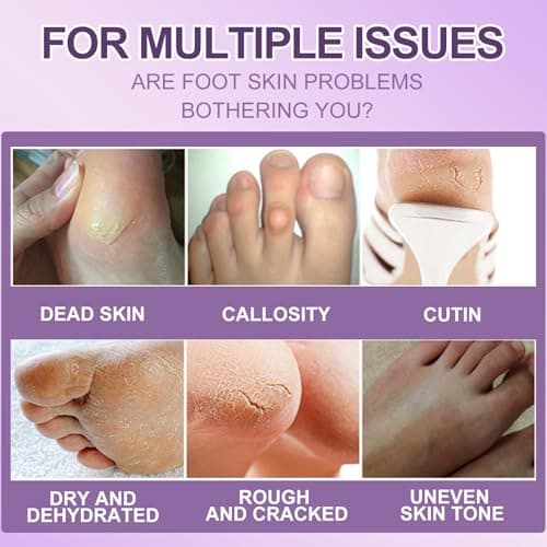 5 Pairs Foot Peel Mask for Hard Skin, Dead Skin Remover for Feet, Exfoliating Foot Mask with Lavender, Moisturising Socks to Repair Cracked Heels & Calluses, Hydrating for Soft Smooth Feet — view 3
