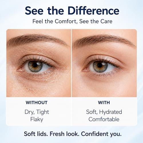 Lanolin Free Eyelid Ointment for Dry Irritated Sensitive Eyelids, Soothing Eye Cream - Moisturising Eye Care for Flaking Tight Skin - Non-Greasy Gentle Cream for Daily Care (10G) — view 5