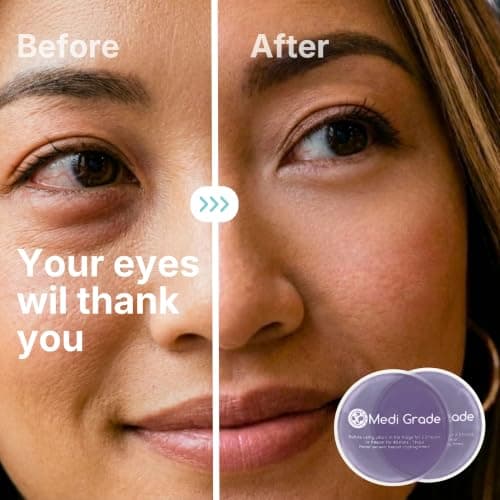Medi Grade Cooling Eye Mask for Puffy Eyes, Cold Compress Gel Pads, Purple — view 6