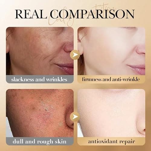Sadoer Collagen Anti Aging Sleep Facial Mask with 10 Times More Collagen Content Active Protein Technology - 20 pcs — view 6