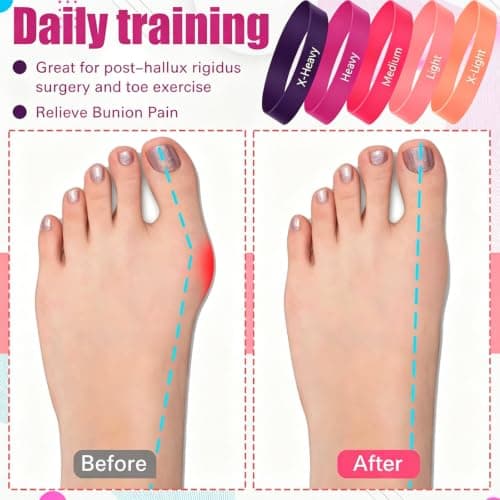 WRWIZDR TPE Toe Fitness Set Toe Stretch Band for Travel, Purple — view 6
