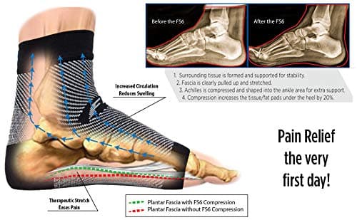 OrthoSleeve FS6 Plantar Fasciitis Foot Compression Sleeves, Natural Large — view 5