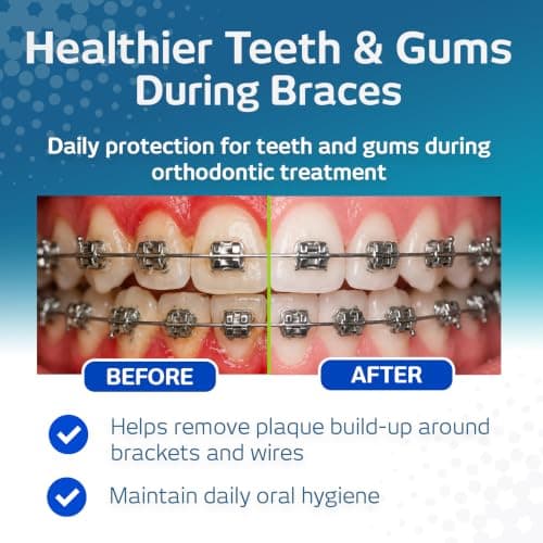 VITIS Orthodontic Travel Kit – Braces Oral Care Set for Daily Cleaning — view 4