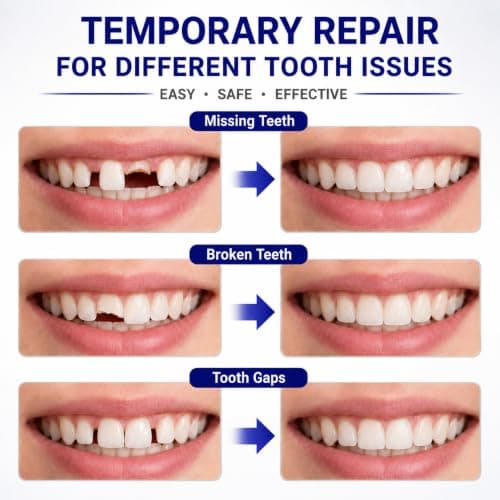 Temporary Tooth Filling Repair Kit, 30ml Emergency Tooth Filler with Tools — view 3