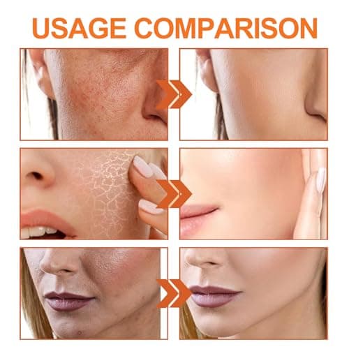 10Pcs Vitamin C Skincare Set & Facial Kit for Outdoor & Beach, Travel Size Skincare Set with Cleanser, Toner, Moisturiser & Sunscreen SPF 50, Brightening Anti-Aging Gift — view 6