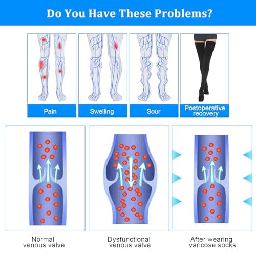 AOGOE Thigh High Compression Stockings for Women & Men, 23-32 mmHg Closed Toe Support Stockings with Anti-Slip Silicone Band, Graduated Compression Socks for Varicose Veins, Edema, Flight, Nursing — view 3