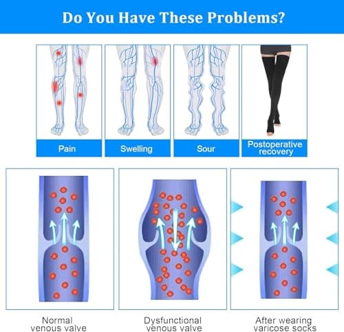 AOGOE Medical Open Toe Thigh High Compression Socks for Women & Men, 23-32 mmHg Open Toe Support Stockings with Anti-Slip Silicone Band, Graduated Compression Socks for Varicose Veins, Edema, Flight — view 5