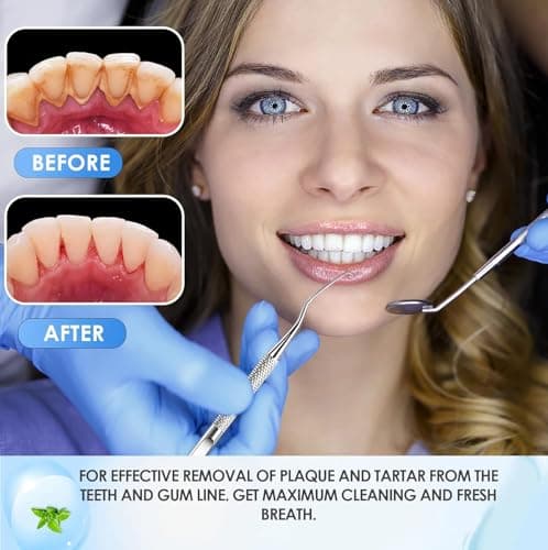 GTEX Plaque Remover for Teeth - 6Pcs Dental Care Kit for Teeth Cleaning - Plaque Removal Tartar Remover Stainless Steel Tongue Scraper Tool for Home Use — view 5