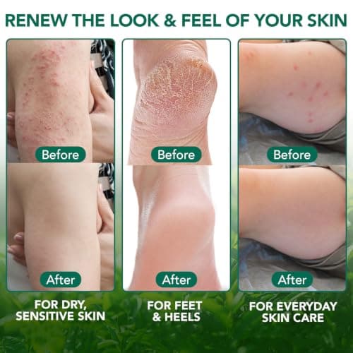 Tea Tree Oil Body Balm With Aloe Vera And Eucalyptus, 60 g, 1 Piece — view 6