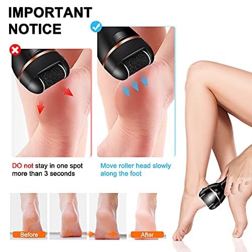 Electric Foot File, Ratukall Hard Skin Remover, Rechargeable Waterproof Callus Remover Pad Feet Care Kit, Professional Pedicure Tools Set with Storage Bag for Dry Dead Skin Cracked Heels Calluses — view 6