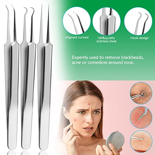 Rovelin Blackhead Remover Tool Kit, Stainless Steel Comedone Extractor Set — view 3