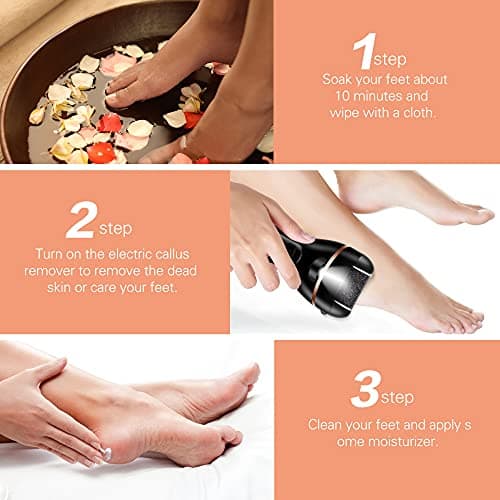 Electric Foot File, Ratukall Hard Skin Remover, Rechargeable Waterproof Callus Remover Pad Feet Care Kit, Professional Pedicure Tools Set with Storage Bag for Dry Dead Skin Cracked Heels Calluses — view 5
