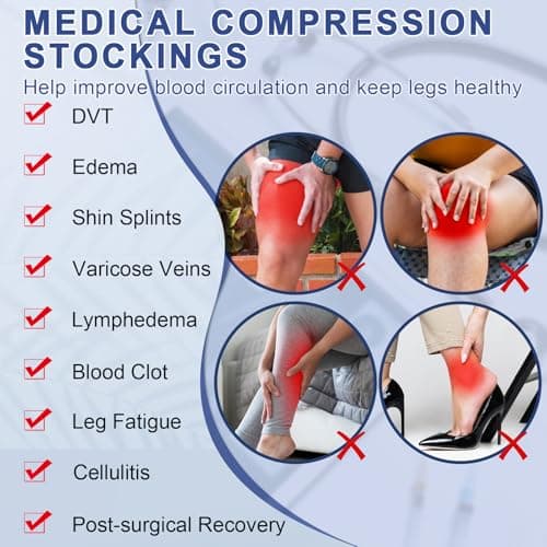 Beister 20-30 mmHg Compression Socks for Women Men, Open Toe Thigh High — view 4