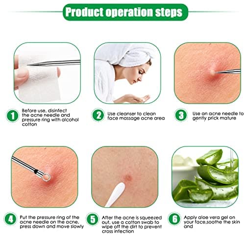Rovelin Blackhead Remover Tool Kit, Stainless Steel Comedone Extractor Set — view 6