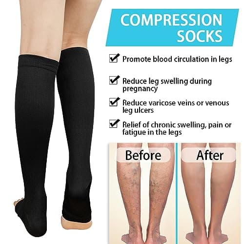 ACWOO Compression Socks for Women & Men, 2 Pairs Open Toe Graduated Stockings Support, Non-Slip Flight Socks Running Socks for Sports, Flying, Maternity Pregnancy, Nurses, Travel, Running — view 4