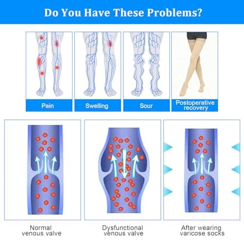 AOGOE Thigh High Compression Stockings for Women & Men, 23-32 mmHg Closed Toe Support Stockings with Anti-Slip Silicone Band, Graduated Compression Socks for Varicose Veins, Edema, Flight, Nursing — view 4