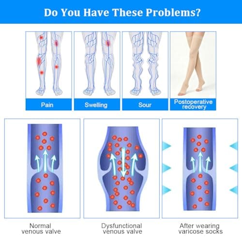 AOGOE Medical Open Toe Thigh High Compression Socks for Women & Men, 23-32 mmHg Open Toe Support Stockings with Anti-Slip Silicone Band, Graduated Compression Socks for Varicose Veins, Edema, Flight — view 5