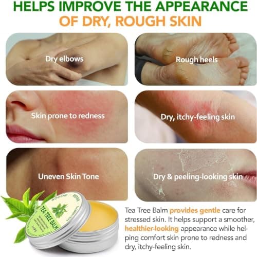 Tea Tree Oil Body Balm With Aloe Vera And Eucalyptus, 60 g, 1 Piece — view 2