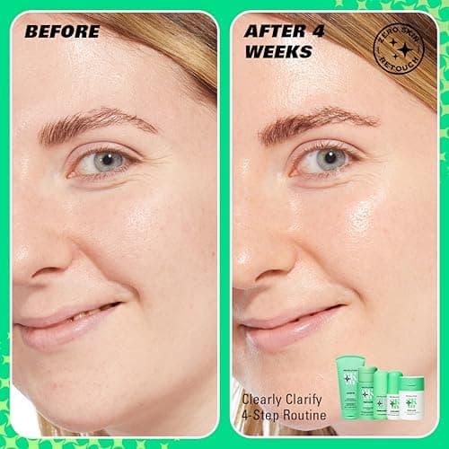 Revolution Skin, Clearly Clarify 4 Step Starter Kit, Skincare Set for Blemish-Prone Skin, Includes Cleanser, Toner, Serum & Moisturiser, Vegan & Cruelty-Free, 4 Products Included — view 3