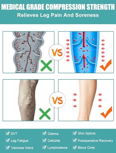 15-20mmhg Lang Compression Socks for Women Men Lipedema Thigh High Socks — view 2
