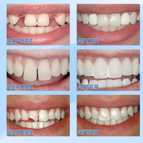 Soft Adjustable Silicone Dentures Teeth Top and Bottom, False Teeth Set Full Dentures, Comfortable Reline Denture Kit, Natural-Looking Functional Temporary Tooth Filling Repair, Functional Dentures — view 2