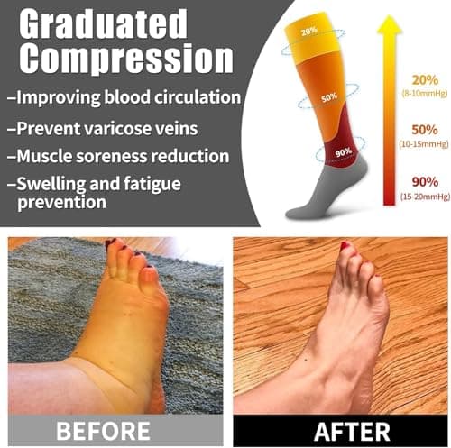 Compression Socks for Women and Men 15-20 mmHg 6 Pack Compression Stockings Circulation-Best Support for Medical,Running,Nursing,Athletic (B-Assorted-1, Large-X-Large) — view 4