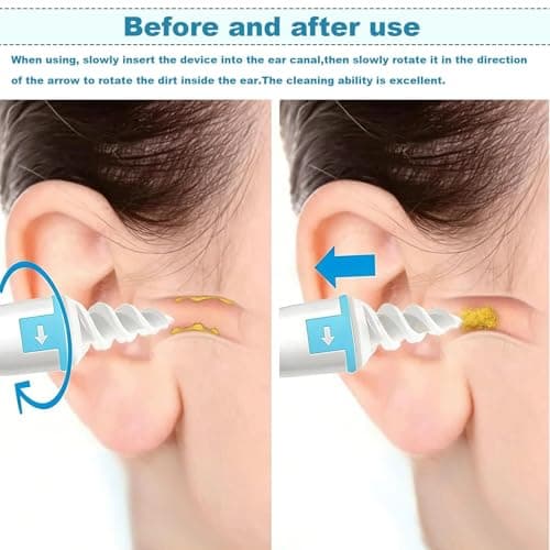 16 Tips Silicone Ear Wax Remover Kit, Reusable Spiral Gentle Ear Care Tool — view 5