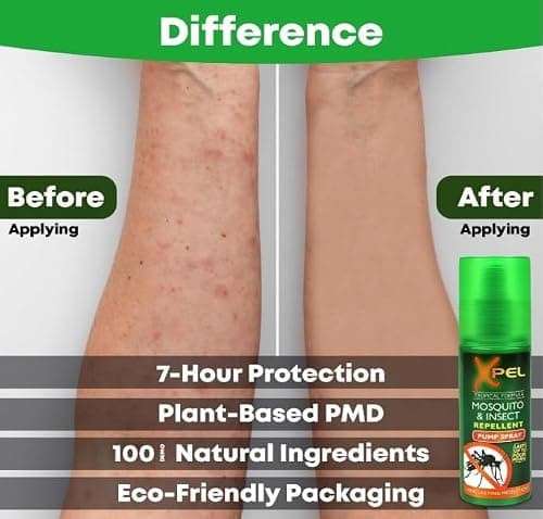 Mosquito & Insect Repellent Spray (2 Pack) + After Bite Pen – Tropical Formula for Bite & Sting Relief, Fast-Acting, Anti-Itch, Soothing, Cooling, 3-Pack Bundle - Exclusive AG Total Health Bundle — view 3