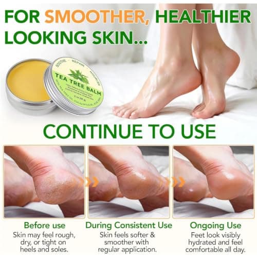 Tea Tree Oil Body Balm With Aloe Vera And Eucalyptus, 60 g, 1 Piece — view 5