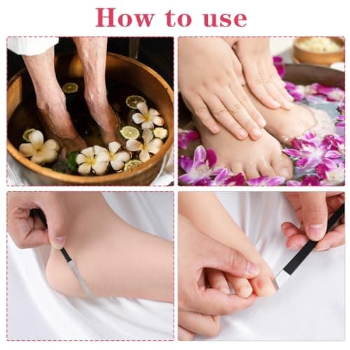 MBAIYO 6 Pack Ingrown Toenail Removal Kit, Professional Pedicure Tools for Ingrown Toenail Callus Shaver Corn Removers for Toes Stainless Steel Nail Knives Kit with Storage Box — view 4